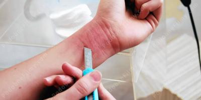 samookaleczenie filmy